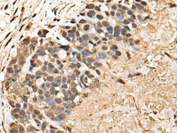BUD31 Polyclonal Antibody - image 1