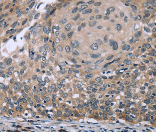 P53RFP Polyclonal Antibody - image 1