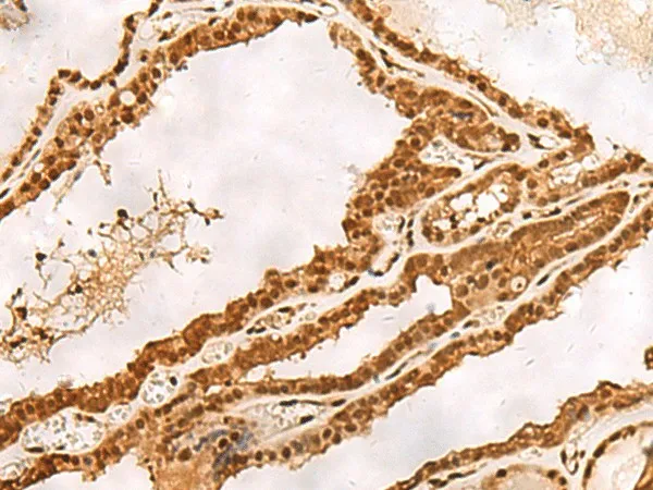 PSMA3 Polyclonal Antibody - image 1