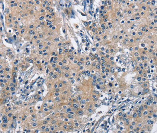 TRIP4 Polyclonal Antibody - image 1