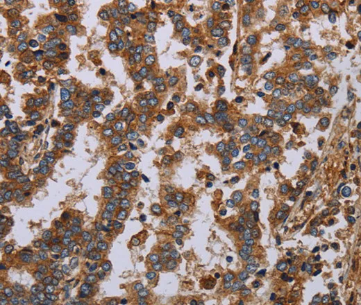 GDF2 Polyclonal Antibody - image 1