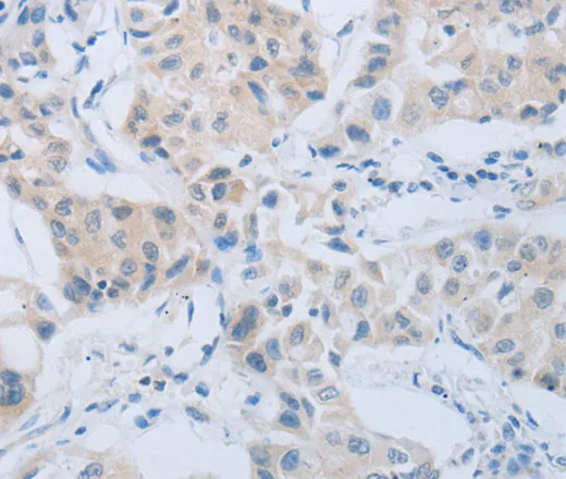 CD10 Polyclonal Antibody - image 1