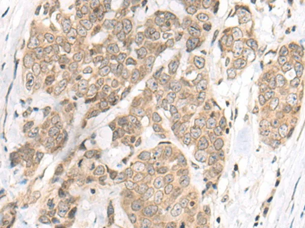 M1AP Polyclonal Antibody - image 1