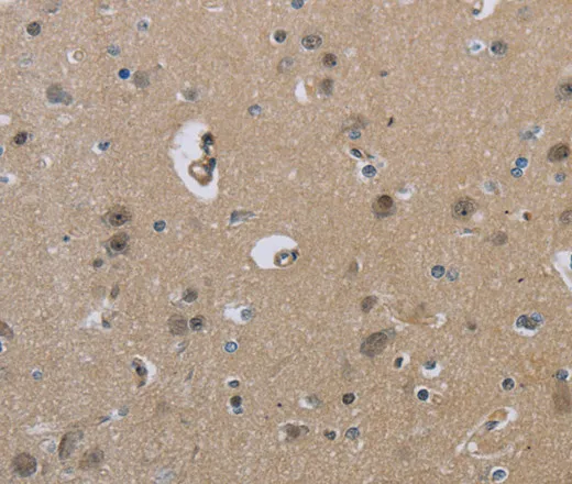 HSD3B1 Polyclonal Antibody - image 1
