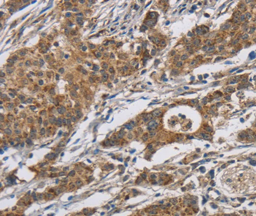 RAGE Polyclonal Antibody - image 1