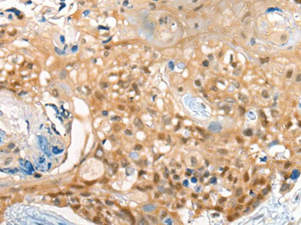 CBR3 Polyclonal Antibody - image 1