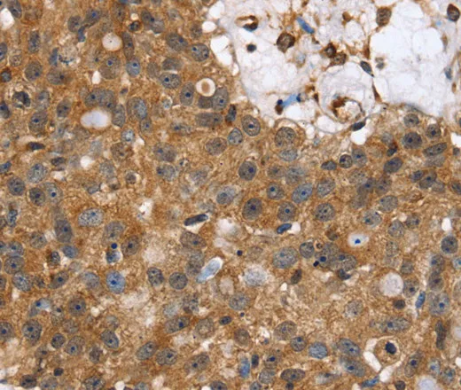 TPM2 Polyclonal Antibody - image 1