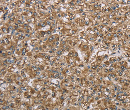 CERS4 Polyclonal Antibody - image 1