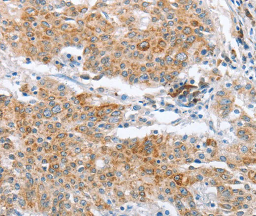 CRELD2 Polyclonal Antibody - image 1