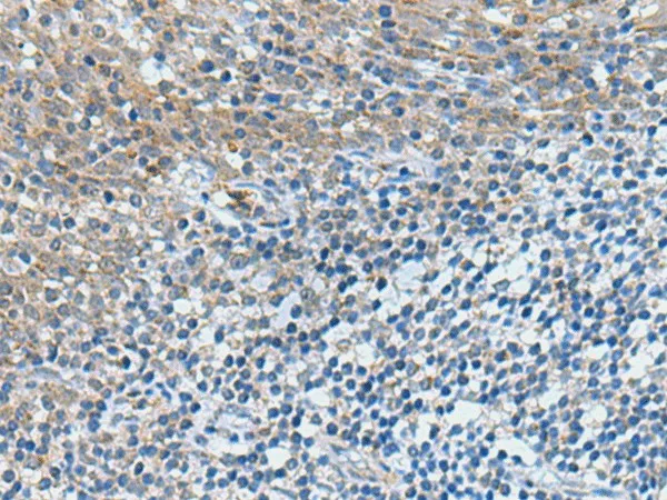 GPCPD1 Polyclonal Antibody - image 1