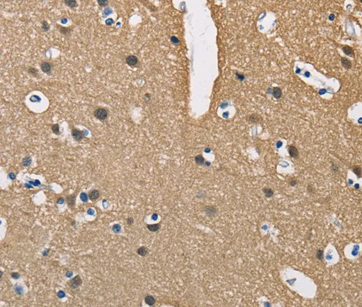PPP3CA Polyclonal Antibody - image 1