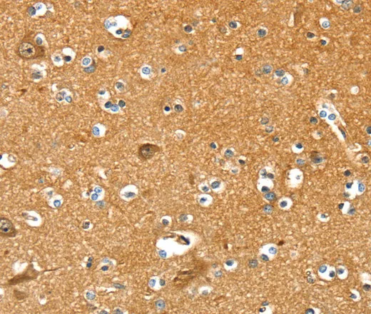 PYGL Polyclonal Antibody - image 1