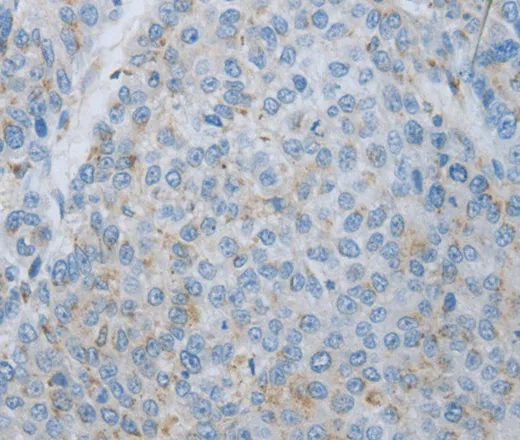 MMP25 Polyclonal Antibody - image 1