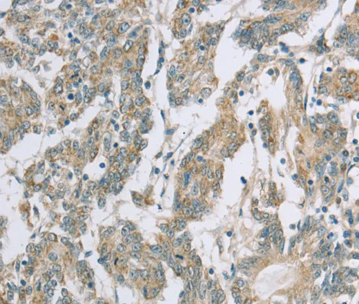 EDA2R Polyclonal Antibody - image 1