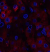 STAT1 Polyclonal Antibody - image 1