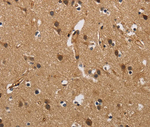 FABP2 Polyclonal Antibody - image 1