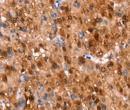 GH1 Polyclonal Antibody - image 1