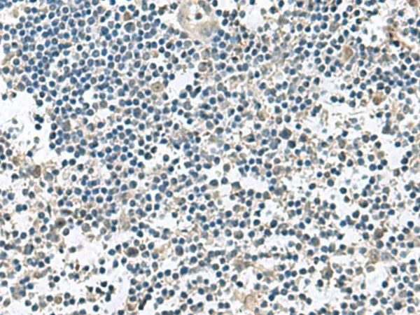 VEGFA Polyclonal Antibody - image 1