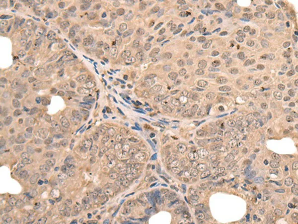 ATF7 Polyclonal Antibody - image 1