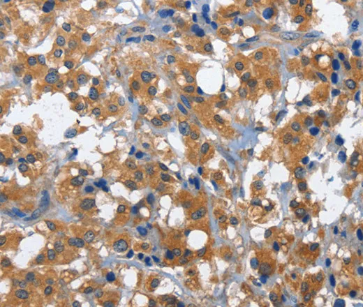 CD27 Polyclonal Antibody - image 1