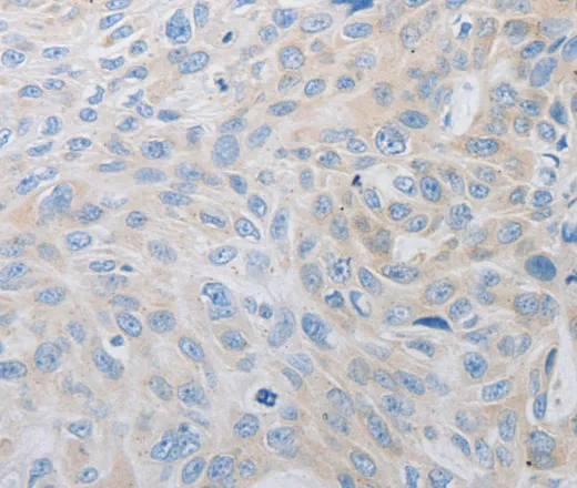 PDX1 Polyclonal Antibody - image 1