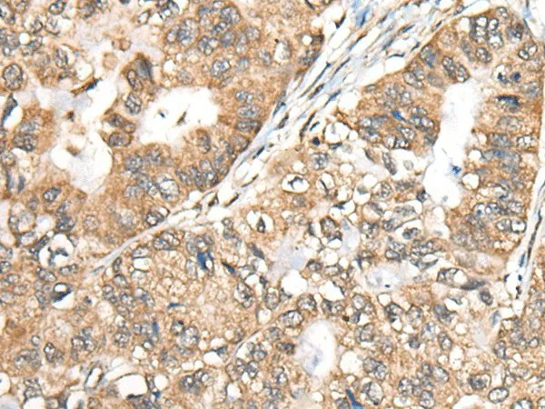 BLNK Polyclonal Antibody - image 1
