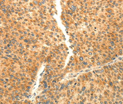 AARS2 Polyclonal Antibody - image 1