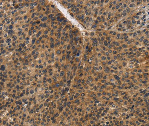 CDC34 Polyclonal Antibody - image 1