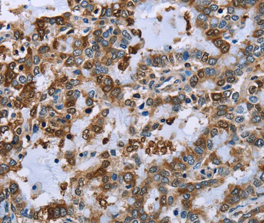 IMPDH2 Polyclonal Antibody - image 1