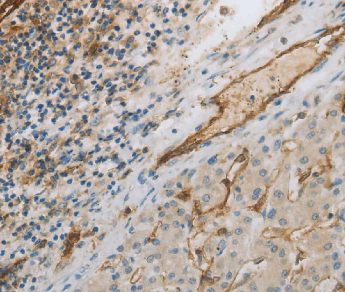 CD31 Polyclonal Antibody - image 1