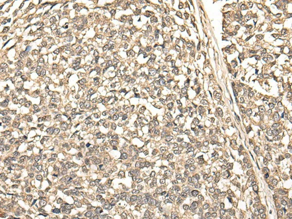 BUD31 Polyclonal Antibody - image 1