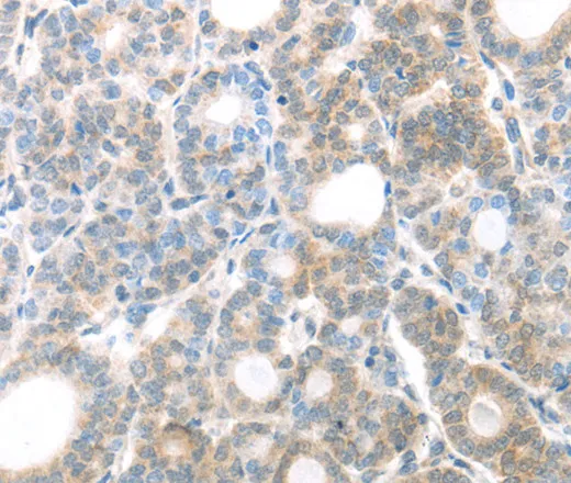 MAGED1 Polyclonal Antibody - image 1