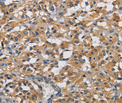 GPM6A Polyclonal Antibody - image 1
