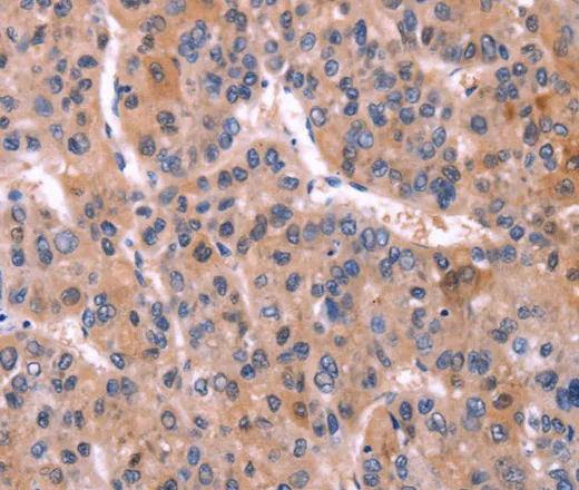 CD269 Polyclonal Antibody - image 1