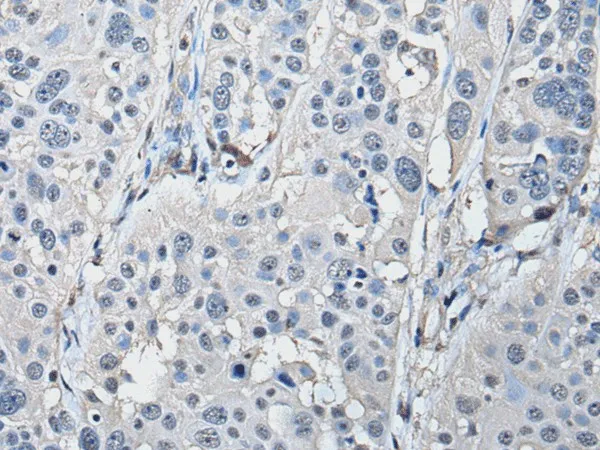 PRKAR2A Polyclonal Antibody - image 1