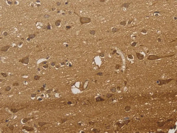 CSNK2B Polyclonal Antibody - image 1