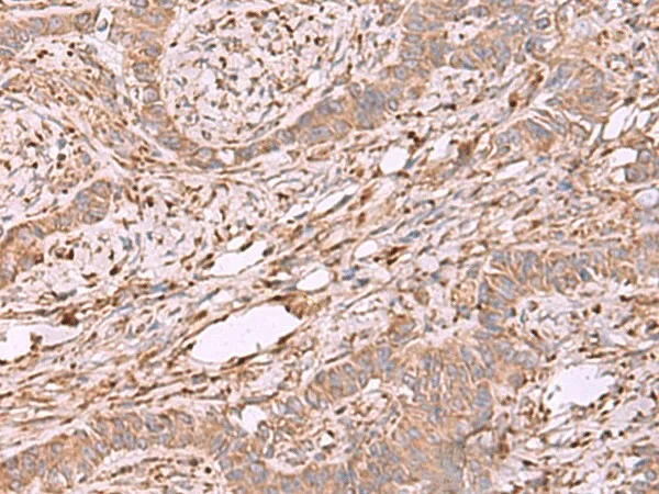EEF1D Polyclonal Antibody - image 1