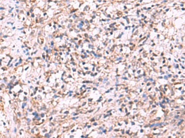 LMCD1 Polyclonal Antibody - image 1