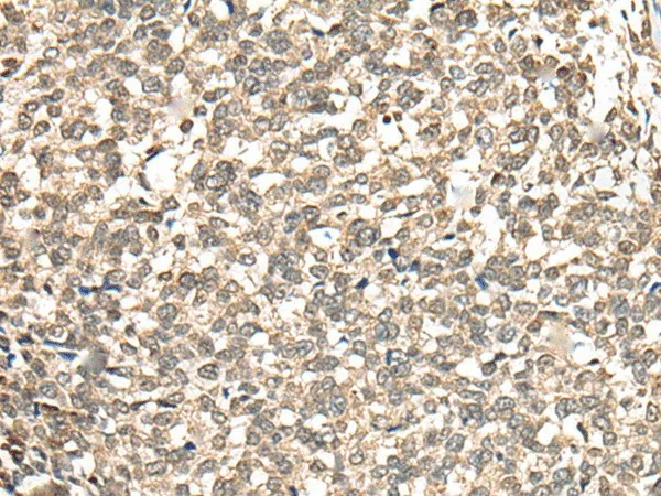 PHF21A Polyclonal Antibody - image 1