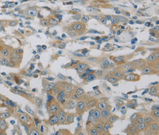MAP2K6 Polyclonal Antibody - image 1
