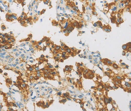 IDH3G Polyclonal Antibody - image 1