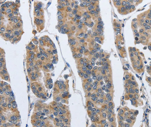 IPO7 Polyclonal Antibody - image 1