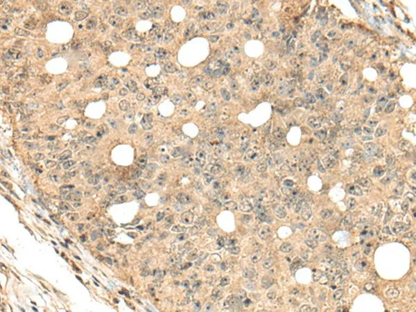 CA7 Polyclonal Antibody - image 1