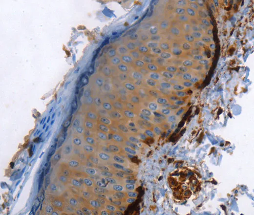 Caldesmon Polyclonal Antibody - image 1