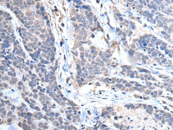 TRIM27 Polyclonal Antibody - image 1