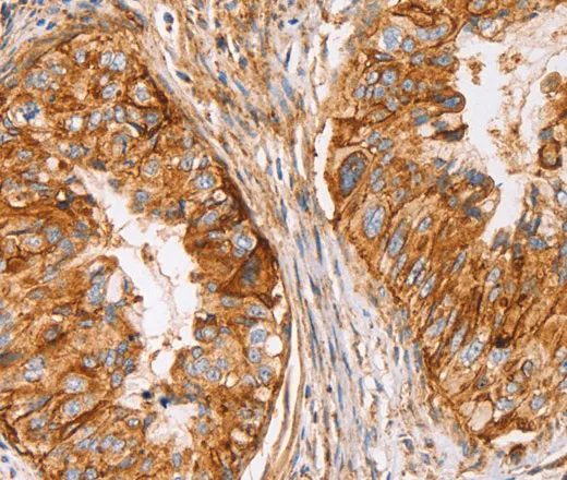 CD59 Polyclonal Antibody - image 1