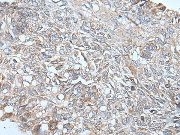 ETFB Polyclonal Antibody - image 1