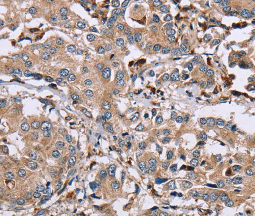 MAGEA3 Polyclonal Antibody - image 1