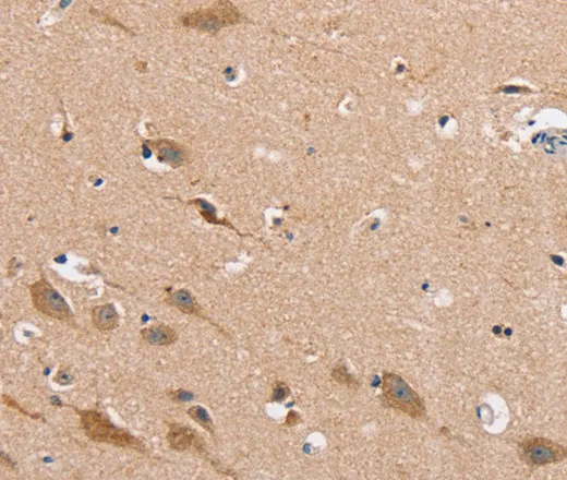 MSMB Polyclonal Antibody - image 1