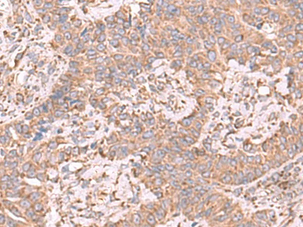 EEF1D Polyclonal Antibody - image 1